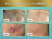 どこに行っても改善が見られなかった全てのお客様の味方です★