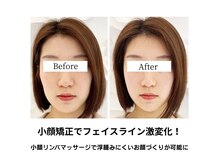 エヌ(N)/小顔矯正でフェイスライン激変！