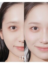 ティーナ(Teena)/毛穴洗浄/眉毛/アイブロウ/眉毛