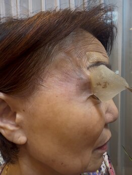 リバース 大宮(Re:Birth)の写真/【顔印象を変える、シミケア革命。】肌本来の力をサポートしシミ悩みから卒業。土台から明るい肌へ♪