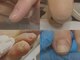 ニーヨンゼロ(240)の写真