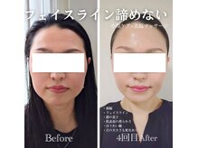 フレル(FUREL)の雰囲気(50代、フェイスラインも変えられる!)