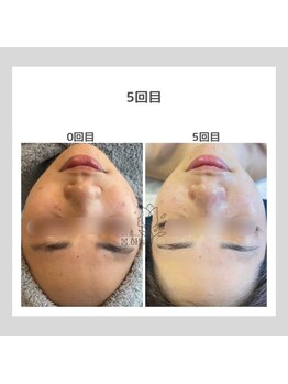 ポムハヌル(pom.haneul)/韓国肌管理室