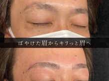 ユー 千葉駅前店(you)/ビフォーアフター写真