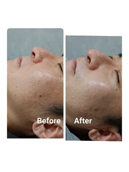 イージープラス つくば店(EASY+)/30代に人気！メンズフェイシャル