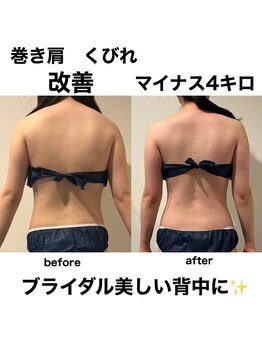 ビューティーサロン ラグジューム(Beauty salon Laxum)/ブライダルエステ