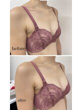 ルミエール(Lumiere)/【倉敷市】バストアップ施術事例