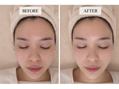 アネーロ(Anhelo)の写真