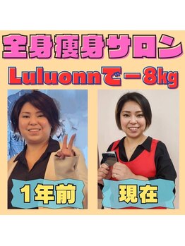 ヨサパーク シピ(YOSAOARK Chipie)/ルルオン