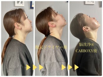 エルミオ エスパシオ ミロク(El mio espacio 369miroku)/倒れなかった首の可動域広がる★