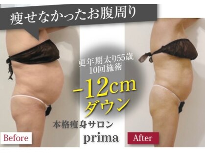 プリマ(prima)の写真