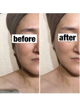 ユジュ(yju)/フェイシャル　肌質根本改良