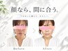 【透明感あふれる素肌へ】バクテリウムピーリング60分　初回￥7,980