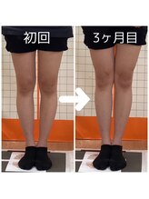 とくしま整体院 藍住院/足のむくみ改善♪