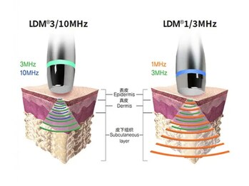 アロハーブ/水玉リフティング（LDM）