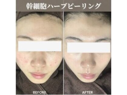 スキンベイビー 新橋(Skin Baby)の写真