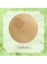 ビューティフィーサロン ベルル(Belulu)/オーダーメイドFビフォー