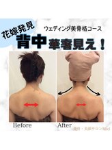 ミエル(Miel)/Before After