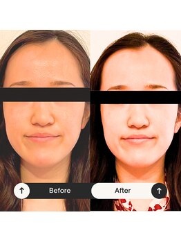 ゆう/ビフォーアフター