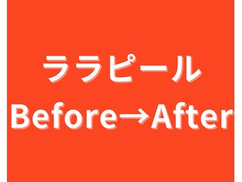 イーラボ 池袋店(e-LABO)/韓国肌管理/ララピール
