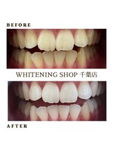 ホワイトニングショップ 千葉店/歯科提携　ホワイトニング専門店