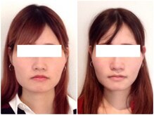 ウェリナ平和堂長久手院/小顔矯正/骨盤矯正/美脚サロン