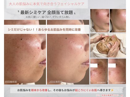 エーワイ(Ay)の写真