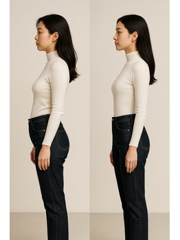 ラクリエ 姫路駅前院(La Creer)/姿勢イメージ【猫背/反り腰】