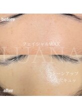 ルアナ(LUANA)/フェイシャルWAX脱毛