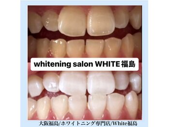 ホワイトニングサロン ホワイト(WHITE)/セルフホワイトニング/大阪/福島