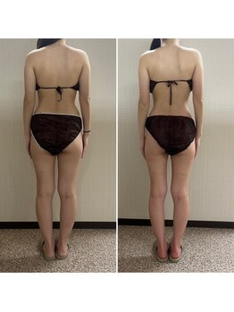 オンディーヌ 名古屋/劇的に!!エステ通いは短期に卒業