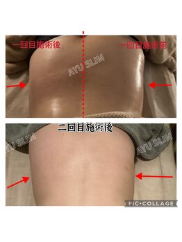 アユスリム(AYU SLIM)/短期集中ケア 充実痩身♪