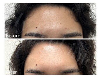 サリエ(s'allier)/プラズマケア☆　男性にも◎