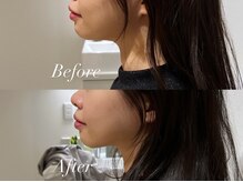 ハクト(Hakuto)/Before/After