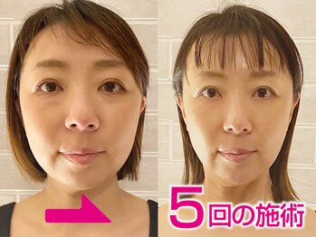 ネルジム 札幌店(NERU GYM)/道内唯一☆美顔デザイン構築術！