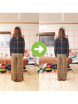 サプライズ整体院/20代ママの初回産後の骨盤矯正