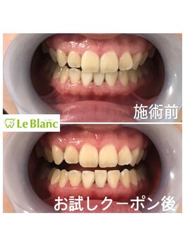 ルブラン 奈良店(Le Blanc)/夏に向けて白く!!