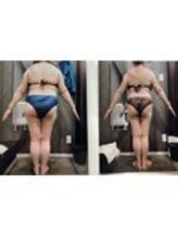 パーフェクトボディプレミアム 渋谷店(PERFECT BODY PREMIUM)/お客様　ビフォーアフター（13）