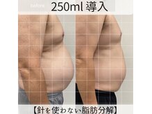 サンポ 神戸元町店(SANPO)/２５０ml導入