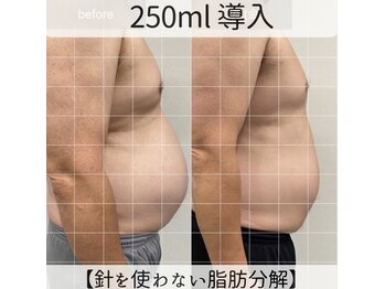 サンポ 神戸元町店(SANPO)/250ml導入