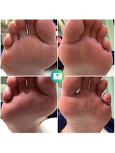 リゼラアンドコー 池袋店/フットキュアコース