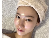 オーロラ 新宿御苑(AURORA)の雰囲気（【2】ララピール★乾燥肌/ざらつき肌/敏感肌/くすみ肌/潤い導入）