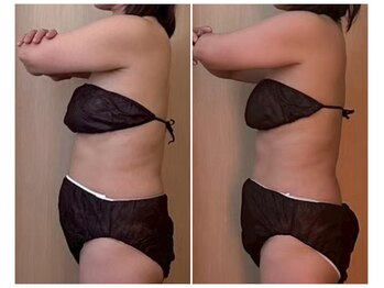 ココア(CoCoa)/活性リンパ洗浄