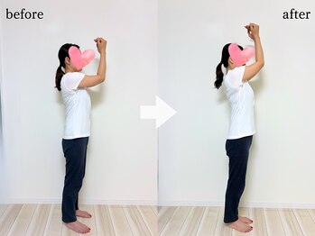 エーアール(AR)/【Before/After】