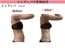 エステサロン ヴリエ 立川店/反り腰さん必見★インディバ