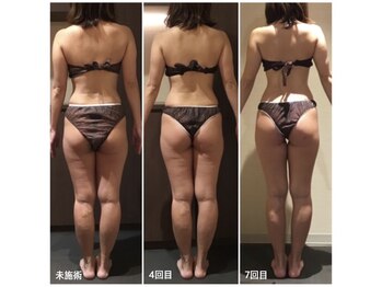 ユジュ(yju)の写真/地域No.1のメニュー数で理想の身体づくりを徹底サポート◎今ならモニター価格でお得に引き締めができます♪