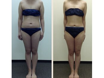 アイル イオン喜連瓜破駅前店/インド式引き締め結果