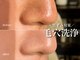 トータルエステサロン ポイント(POINT)の写真
