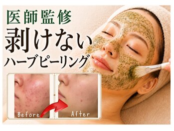 てて整骨院 針ヶ谷店の写真/《美肌＆小顔》剥離なし国産ハーブピーリング×リフトマシンで透明感UP＆輪郭シュッ！諦めていたお悩みに♪