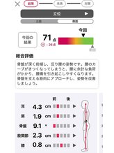 トワニ整体 新富町院(TOWANI整体)/AI姿勢診断【イメージ像】